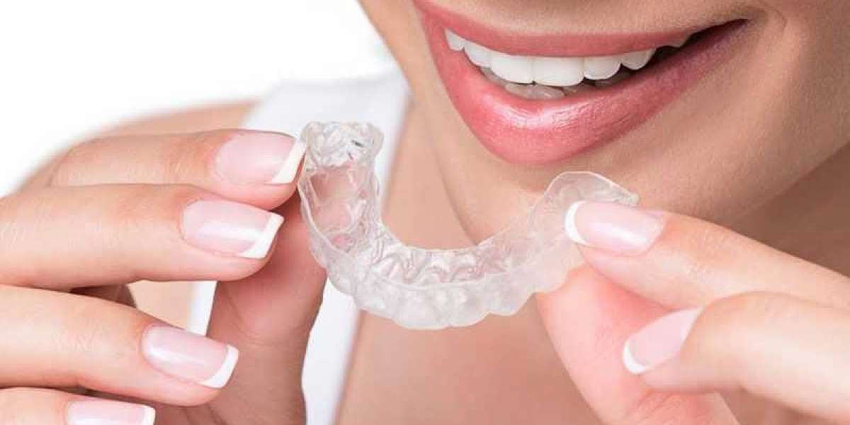 How to Find Invisalign Dentist Near You in Edmonton