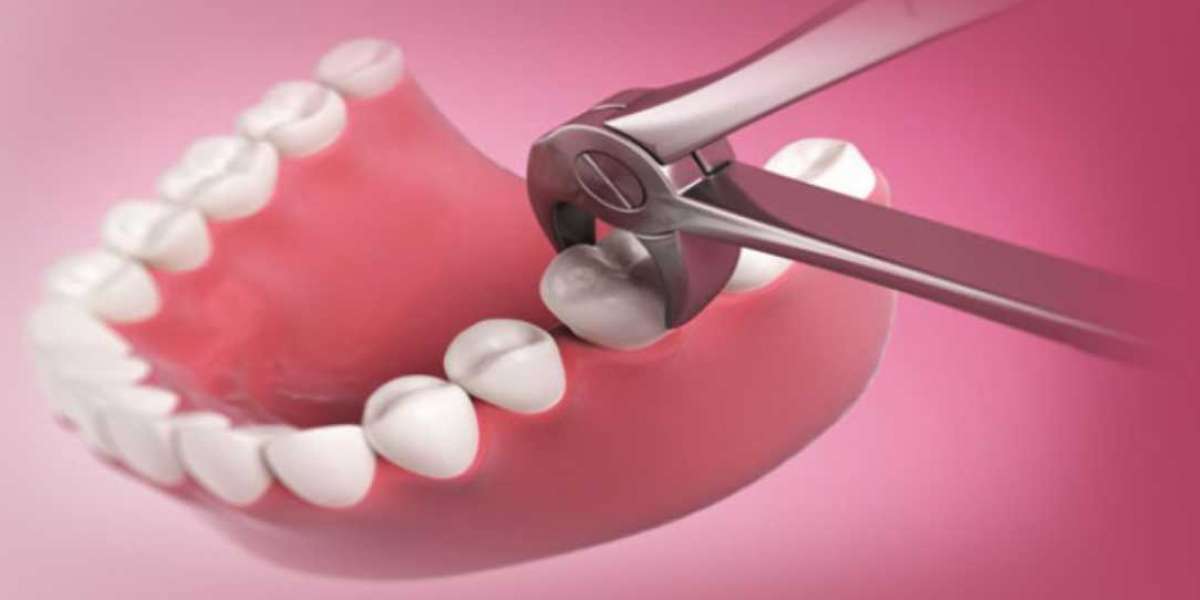 32 Teeth Around Extraction Hurt Keygen Pro Pc Free Iso Registration