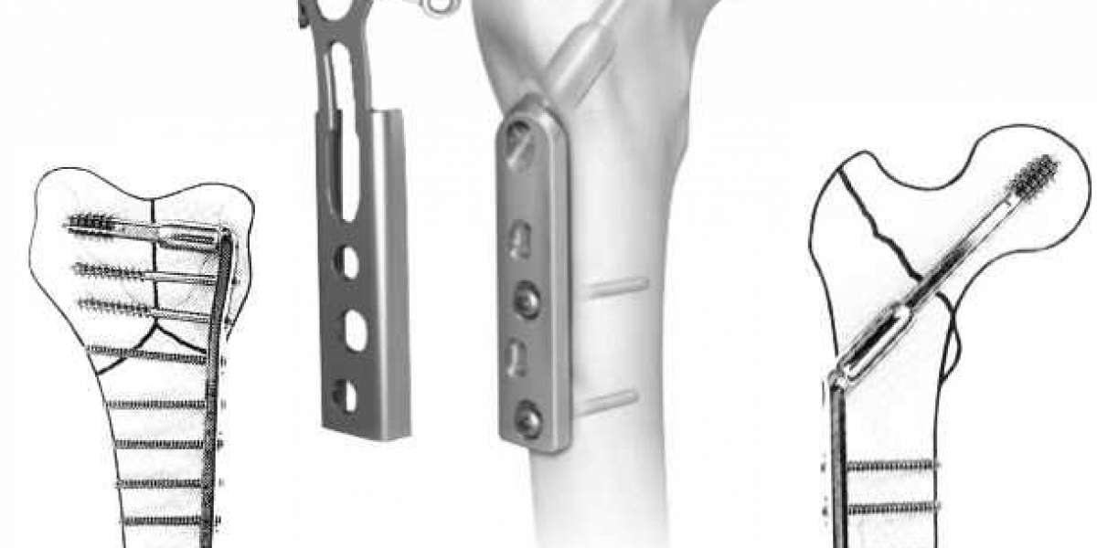 Orthopaedic Products Manufacturer