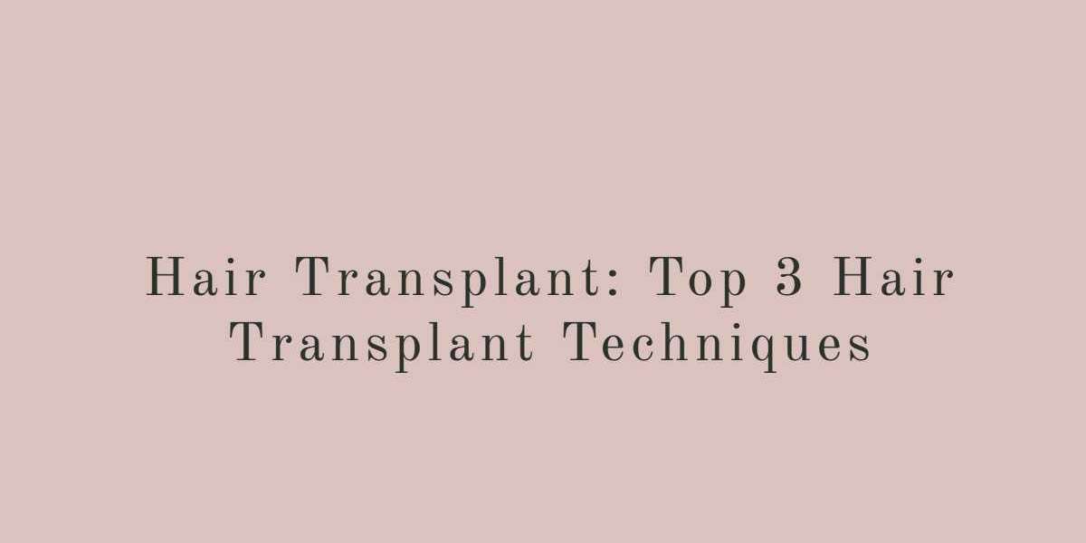 Hair Transplant: Top 3 Hair Transplant Techniques