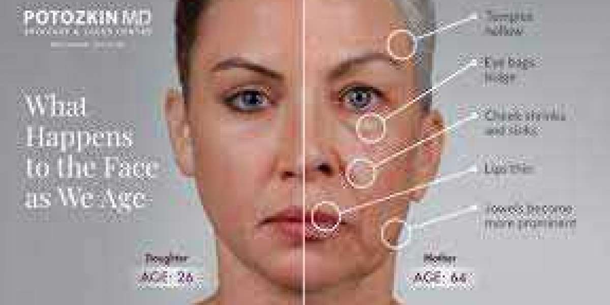 Are Dermal fillers Safe?  Dermal fillers are considered to be safe but side effects can occur