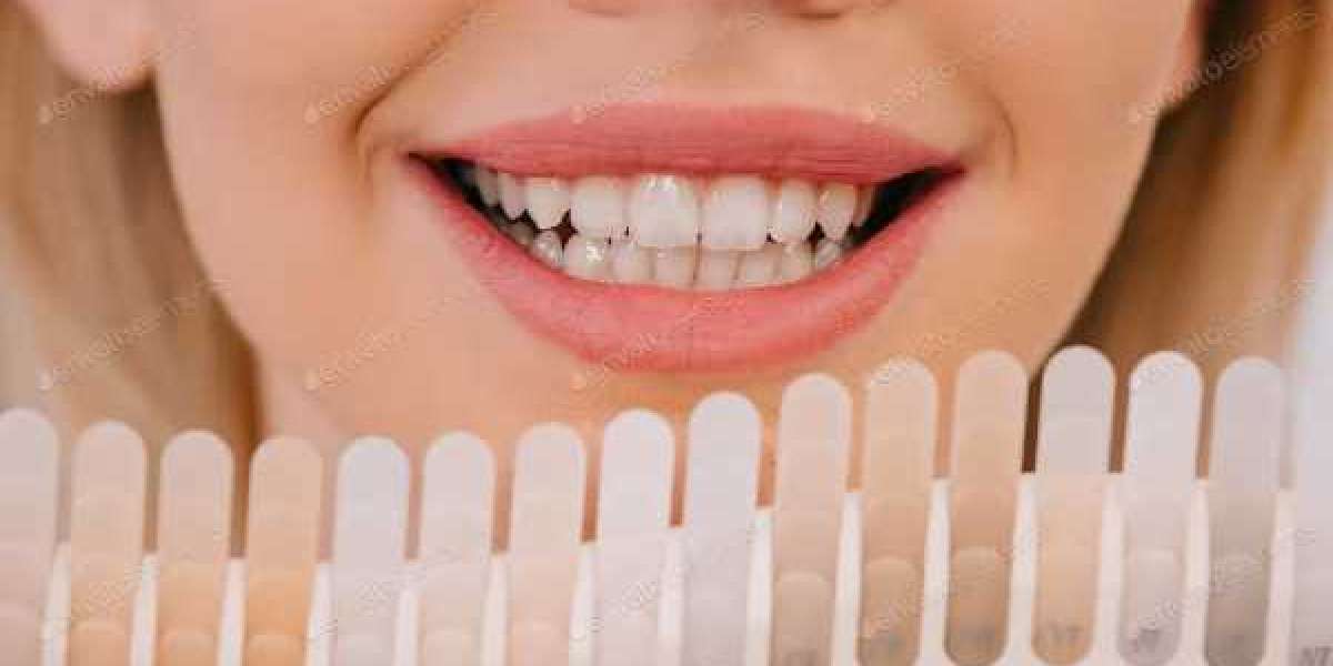 Get a Whiter Smile in Las Vegas with a Professional Teeth Whitening Doctor