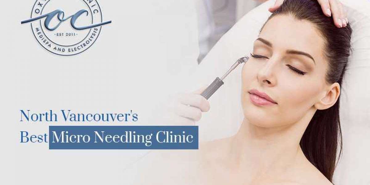 Top Quality Microneedling Service in North Vancouver!