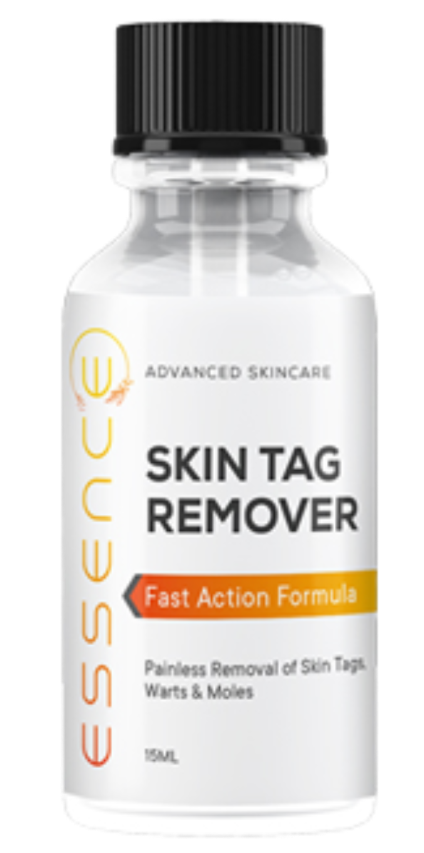 Essence Skin Tag Remover (Untold Truth) Consider Before Buying!