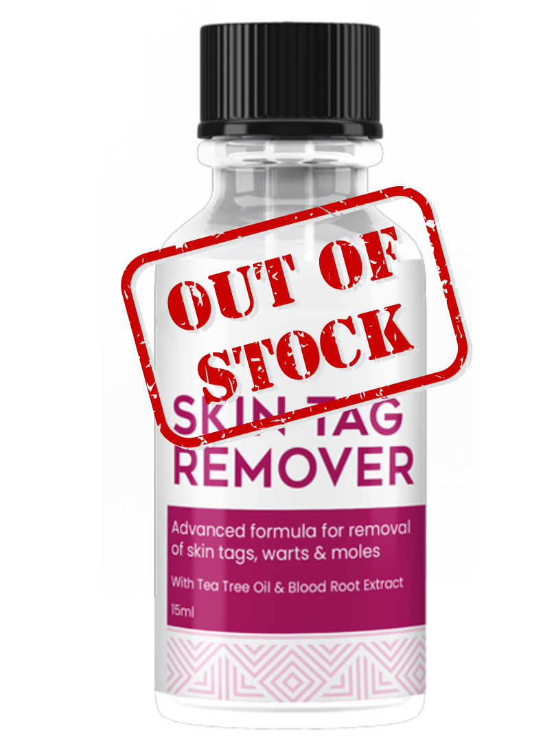 #1 Rated Dermisol Skin Tag Remover [Official] Shark-Tank Episode